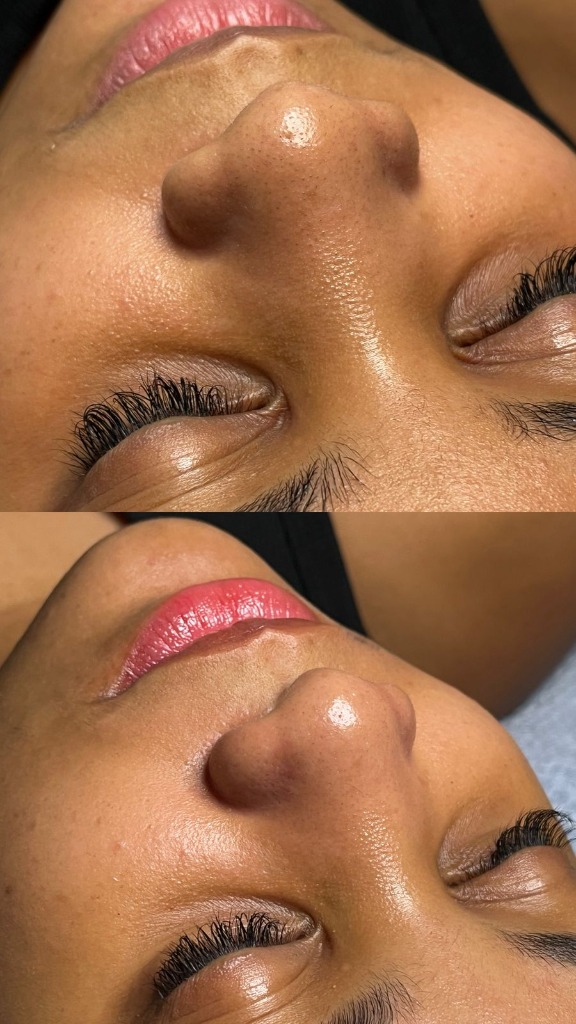 Protocolo de hidratação e renovação facial